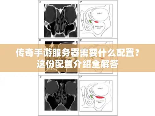 传奇手游服务器需要什么配置？这份配置介绍全解答