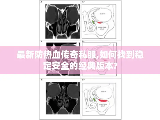 最新防热血传奇私服,如何找到稳定安全的经典版本? 最新防热血传奇私服,如何找到稳定安全的经典版本?