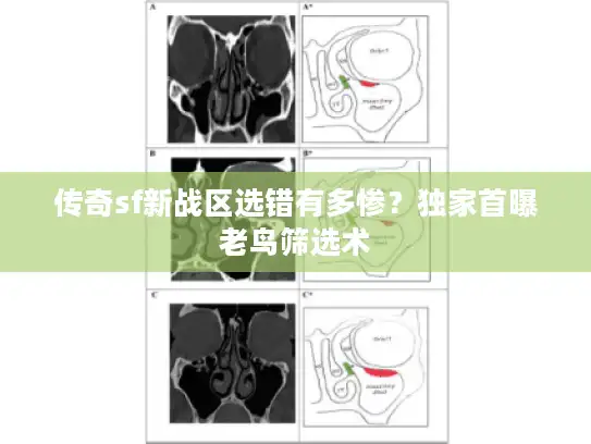 传奇sf新战区选错有多惨?独家首曝老鸟筛选术 传奇sf新战区选错有多惨?独家首曝老鸟筛选术
